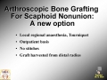 Scaphoid Nonunion