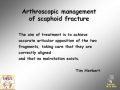 Scaphoid fracture